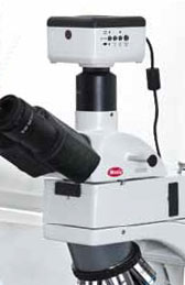 ba310met digital documentation trinocular microscope